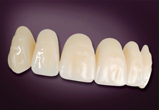 Heraeus Artic Teeth