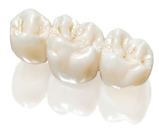 ZIRCONIA RESTORATIONS