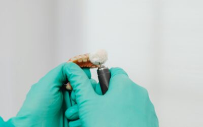 Steps To Prevent Partial Denture-Related Complications
