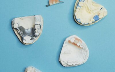 How To Handle Emergency Repairs for Partial Dentures