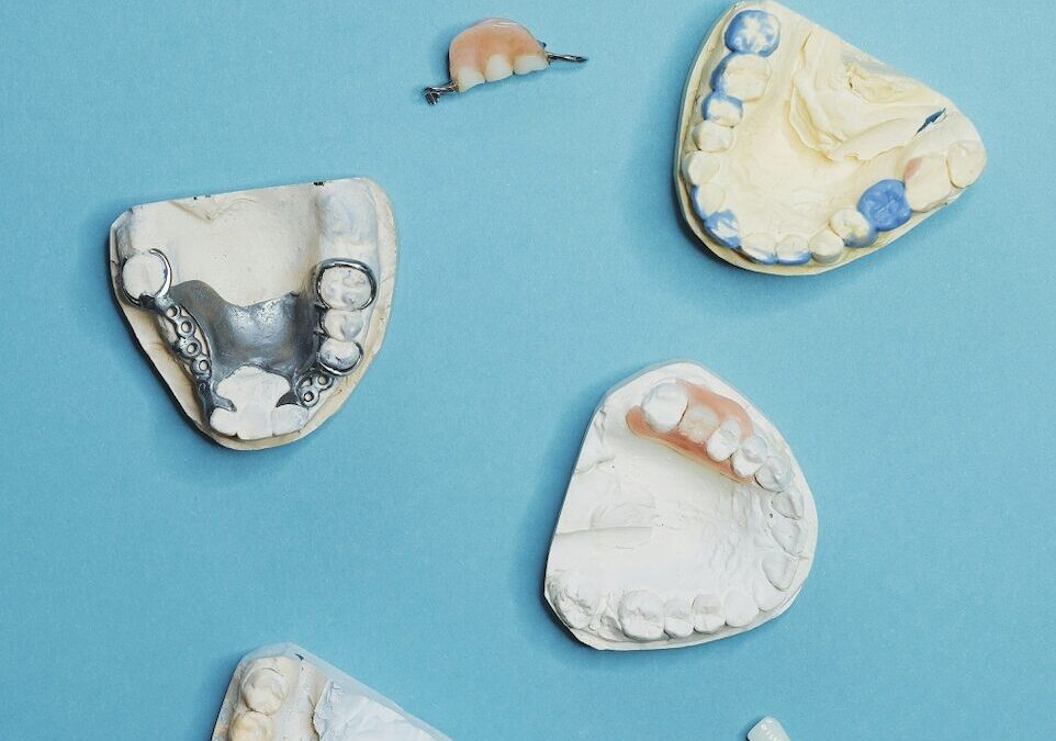 How To Handle Emergency Repairs for Partial Dentures
