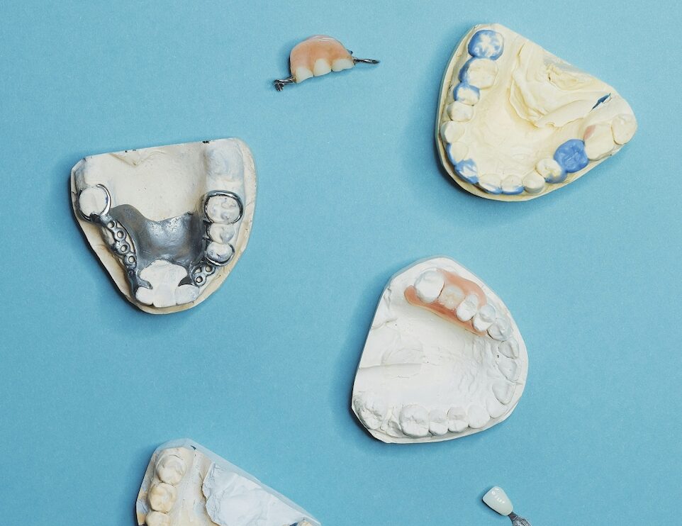 ZIRCONIA RESTORATIONS
