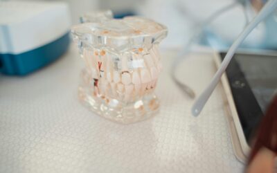 How a Dental Lab Makes Implants
