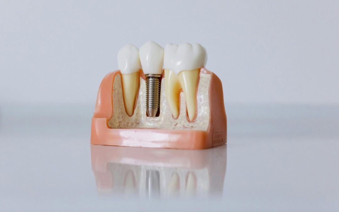What Materials Do Dental Labs Use?