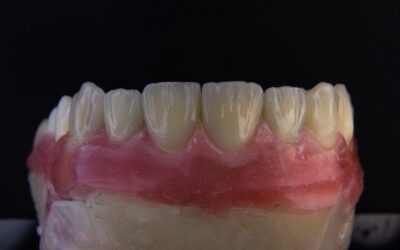 How Dental Labs Use CAD/CAM Technology