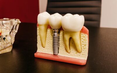 The Benefits of Combining Ceramic and Metal in Dental Restorations