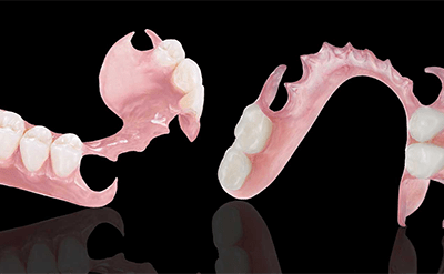 3D Flexible Partials Are Here