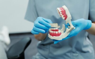 How Metal Alloys Are Used in Dental Restorations